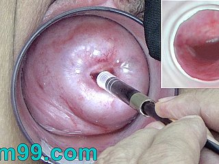 Japanese Endoscope Camera inner Cervix Cam into Vagina